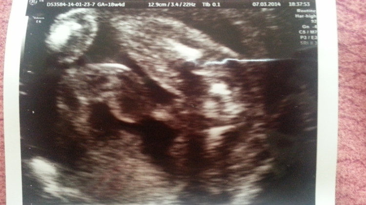 can u guess the gender?