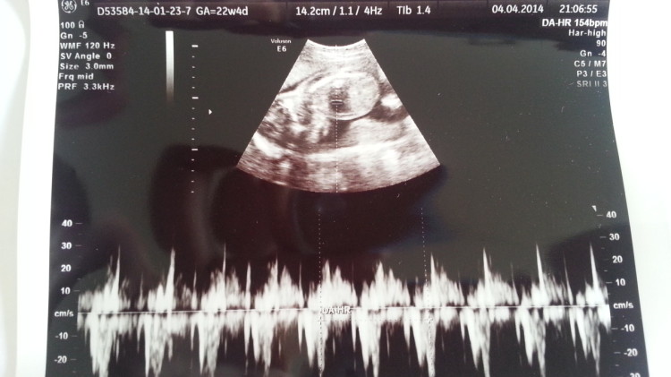 lively heartbeat
