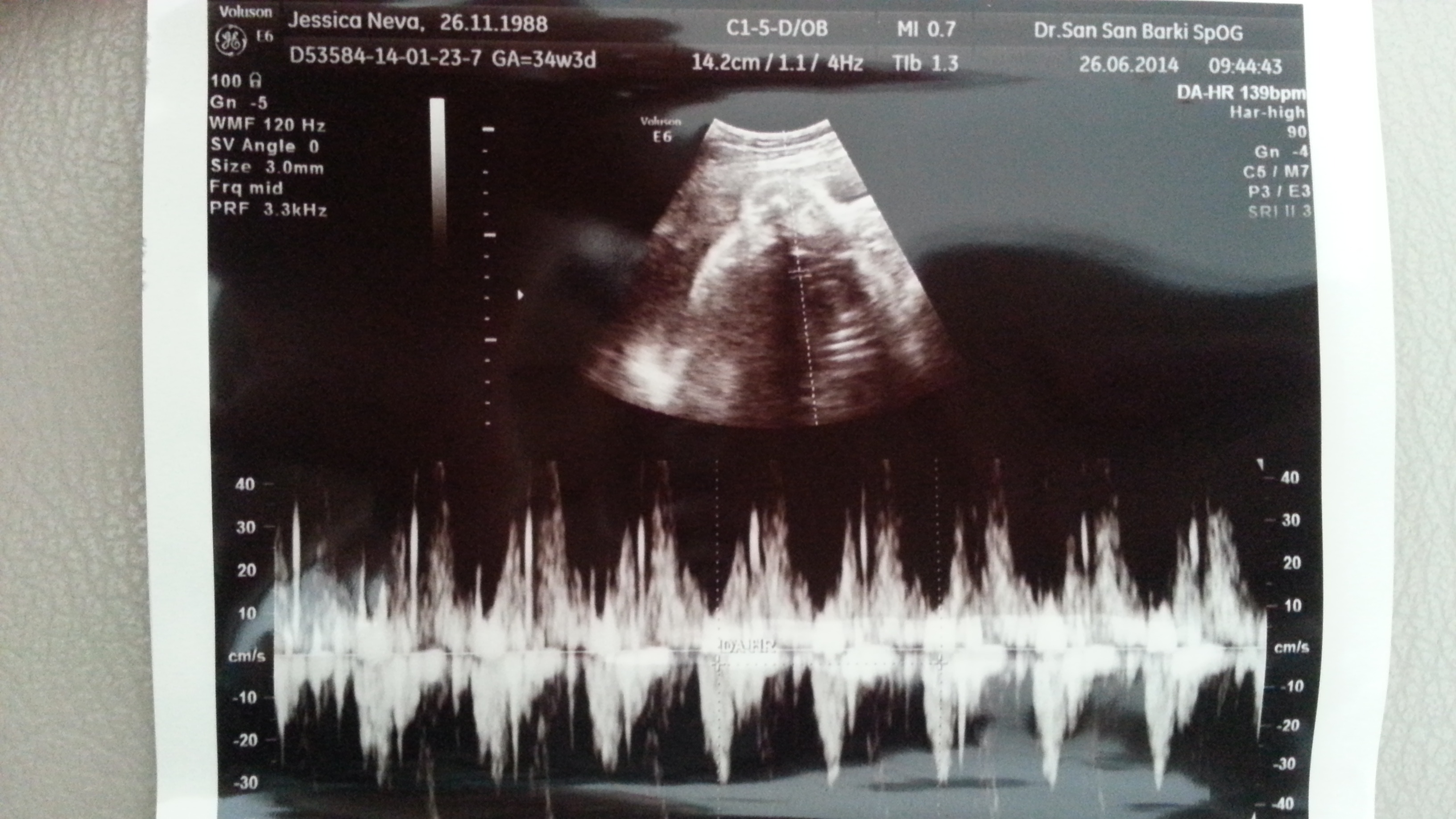 heartbeat at 34 weeks